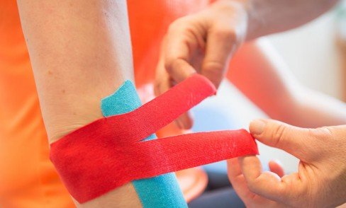 Kinesiotaping